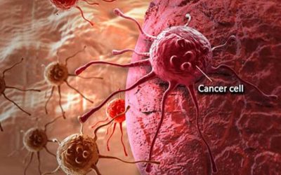 7 Signs and Symptoms of Cancer You Must Know