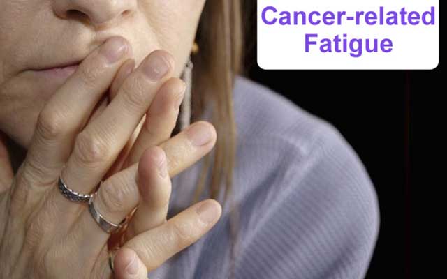 Cancer-related Fatigue