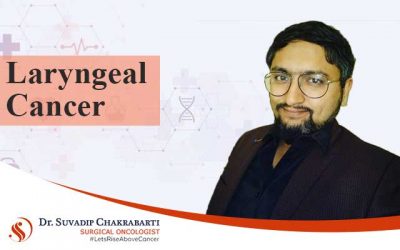 Laryngeal Cancer