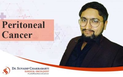 Peritoneal Cancer