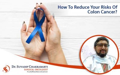 How to Reduce Your Risks of Colon Cancer