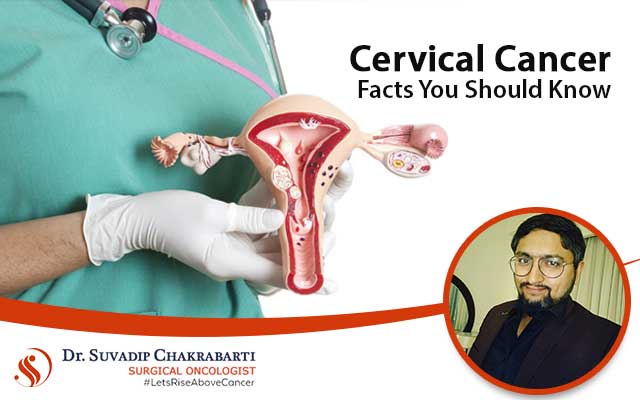 Cervical Cancer Facts You Should Know – Explained By Oncologist