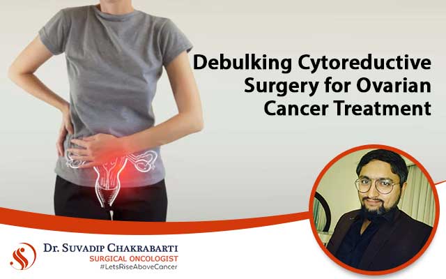 Debulking Cytoreductive Surgery for Ovarian Cancer Treatment