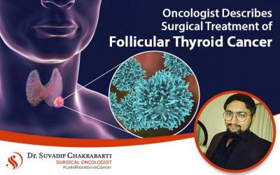 Oncologist Describes Surgical Treatment of Follicular Thyroid Cancer