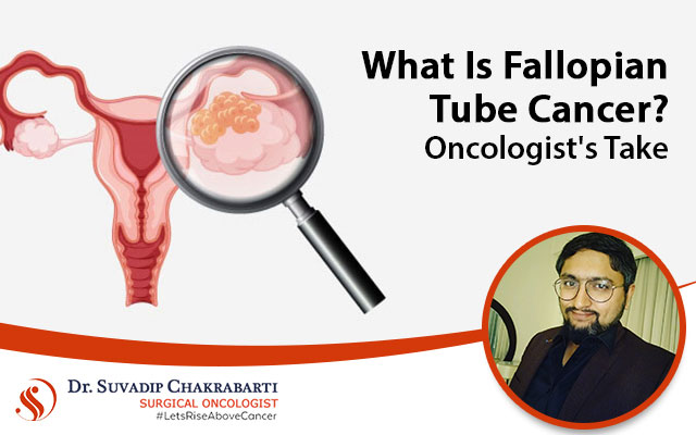 What Is Fallopian Tube Cancer?-Oncologist’s Take