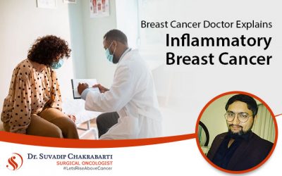 Breast Cancer Doctor Explains Inflammatory Breast Cancer