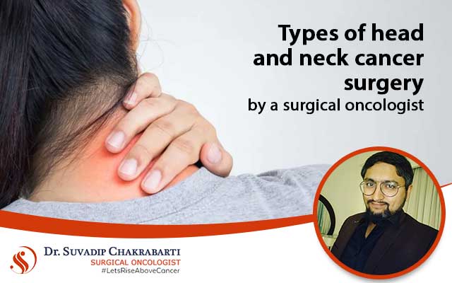 Head & neck cancer surgeries performed by a surgical oncologist.