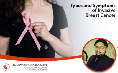 The Most Common Types & Symptoms of Invasive Breast Cancer