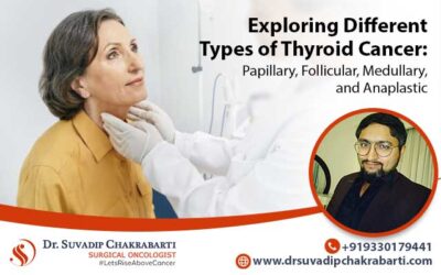 Exploring Different Types of Thyroid Cancer: Papillary, Follicular, Medullary, and Anaplastic