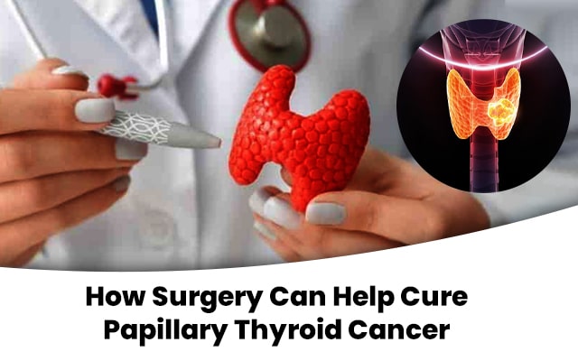 Surgeries for papillary thyroid cancer
