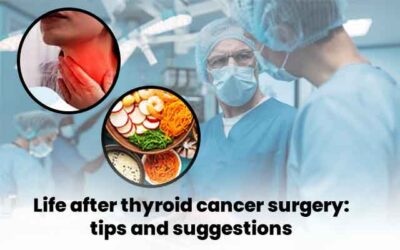 Life after thyroid cancer surgery: tips and suggestions