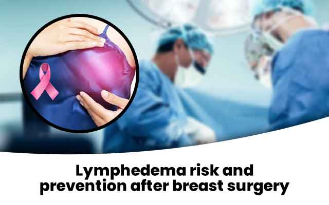 Lymphedema risk and prevention after breast surgery