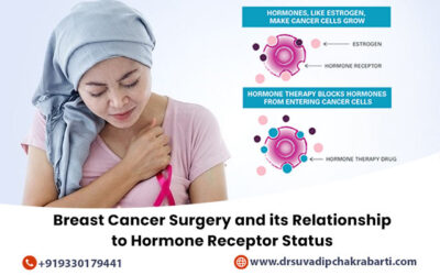 How Hormone Receptor Status Informs the Method of Breast Cancer Surgery