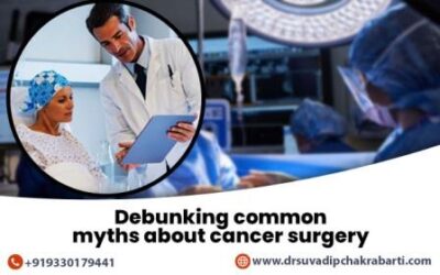 Debunking Common Myths About Cancer Surgery