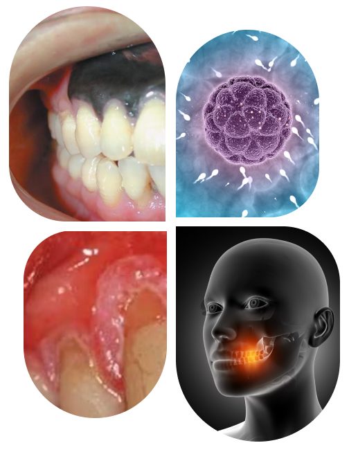 Oral Cavity-img Oral Cavity