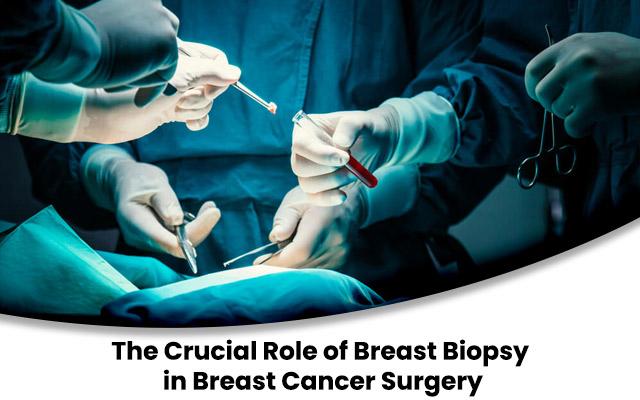 role of breast biopsy