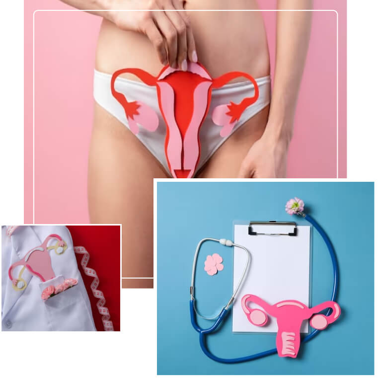 Uterine Cancer Uterine Cancer