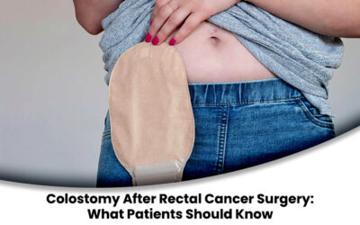 Colostomy After Rectal Cancer Surgery: What Patients Should Know