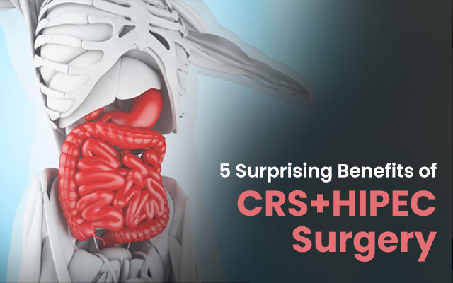 5 Surprising Benefits of CRS+HIPEC Surgery