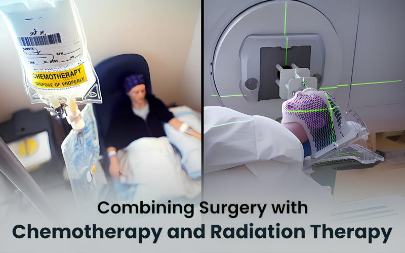 Combining Surgery with Chemotherapy and Radiation Therapy