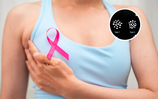 Woman undergoing breast cancer awareness screening with mammogram findings related to breast calcifications evaluation
